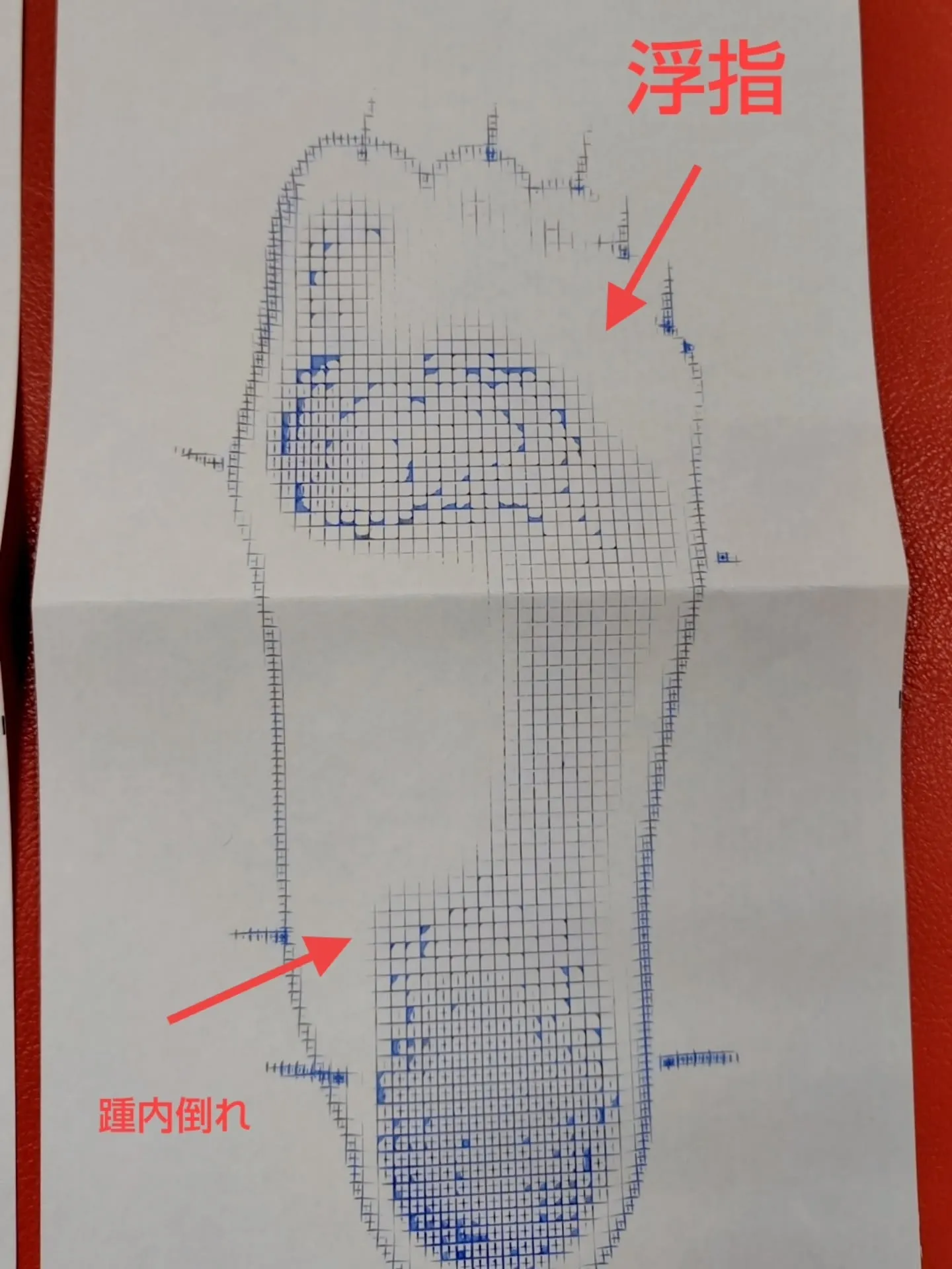 現在通われている方の症例を載せていきます。