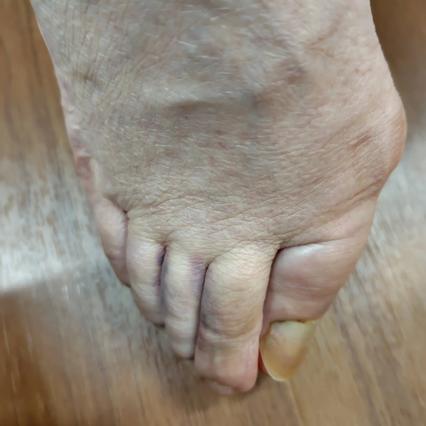 立ち上がる時に転倒してしまい右足を痛めてしまった方に、早期回...