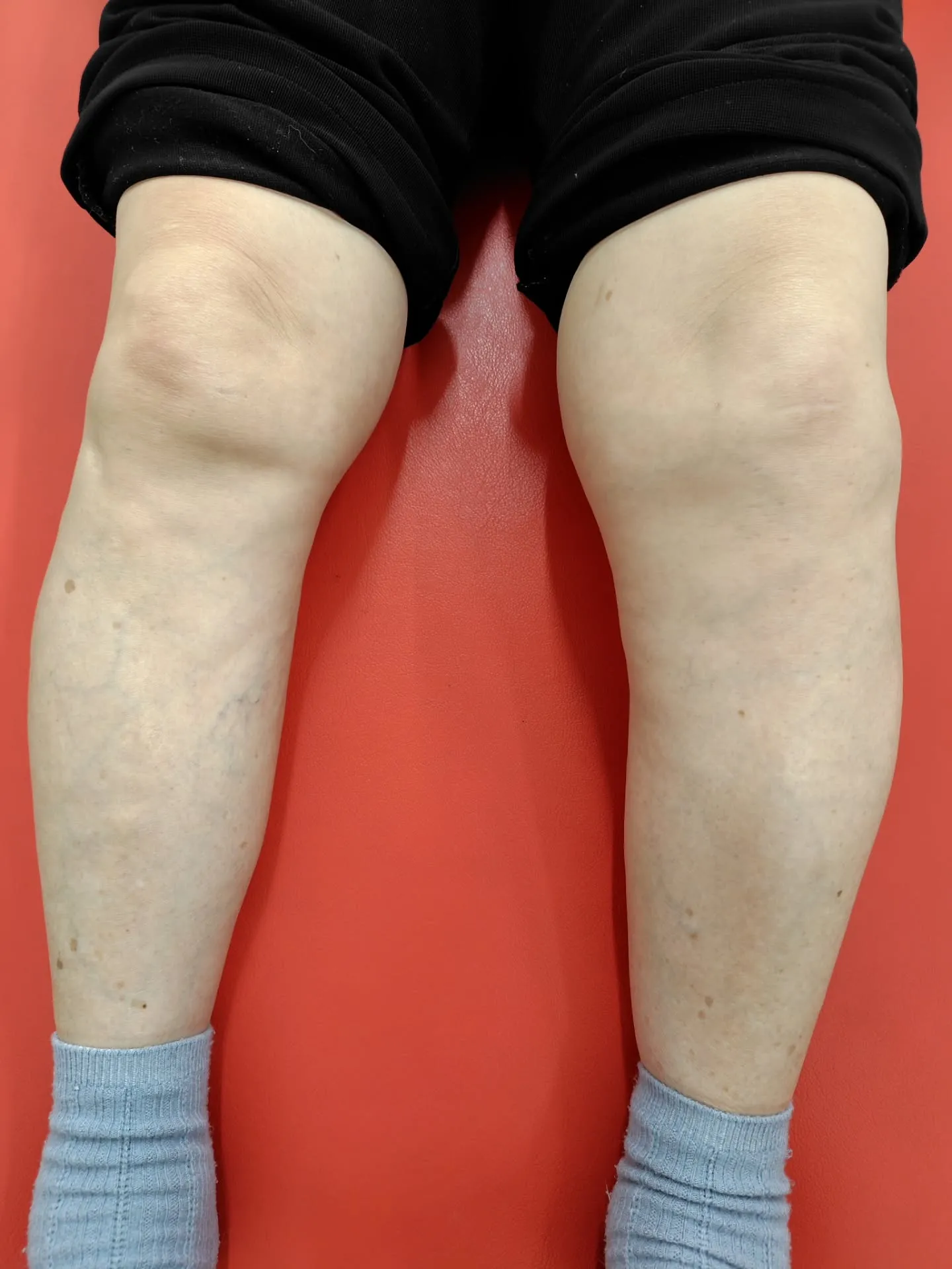 膝の痛みや腰の痛みで歩く時にお悩みがある方に、靴とインソール...