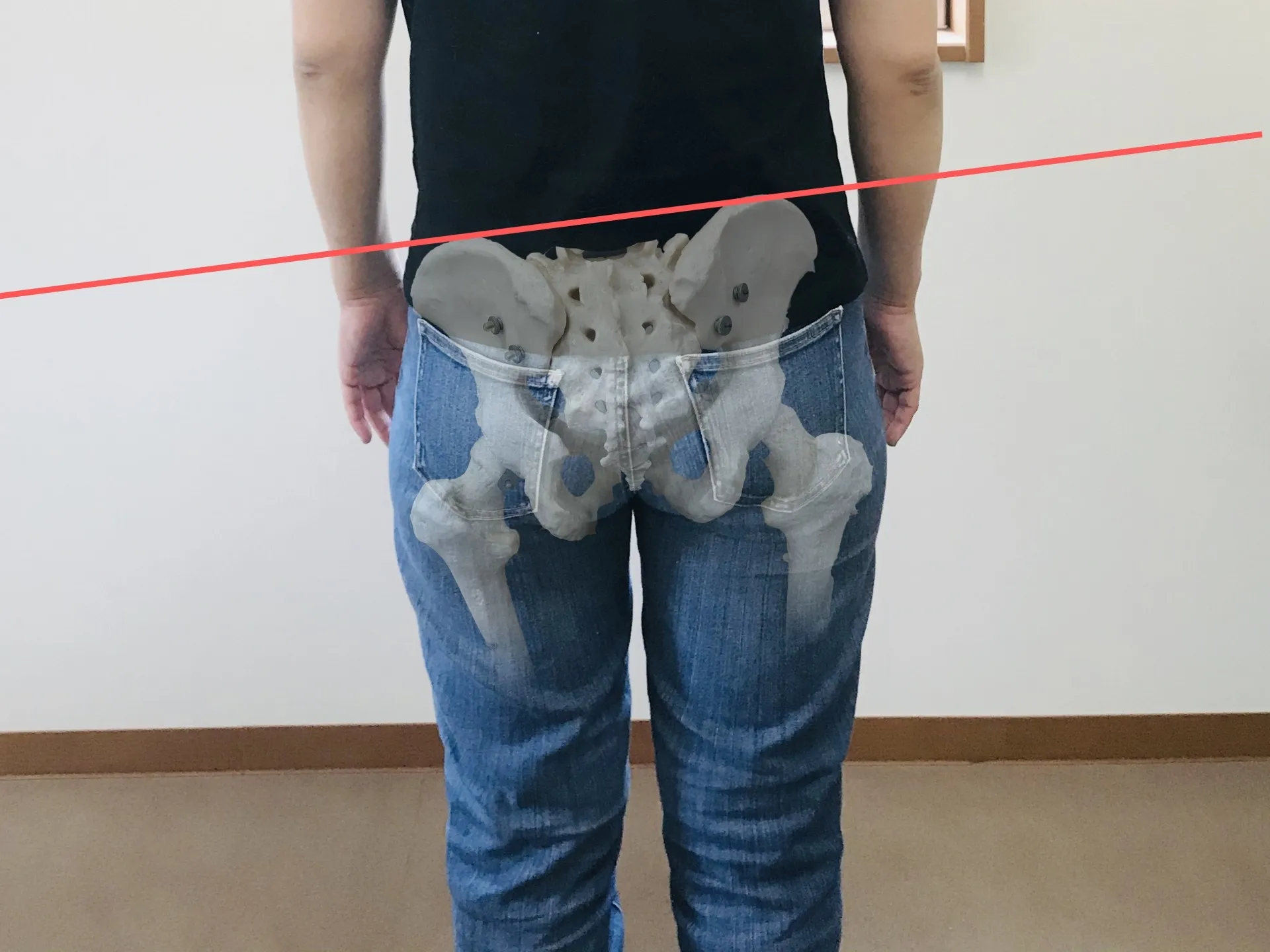患者さんからよく聞かれる骨盤のゆがみと腰痛などの症状との関連