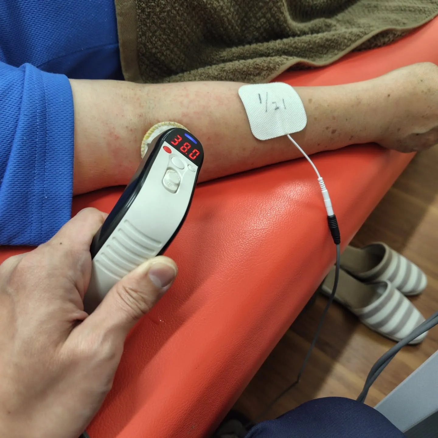 歩いている時に溝に足を取られて転倒してしまい、右肘と左手首の...