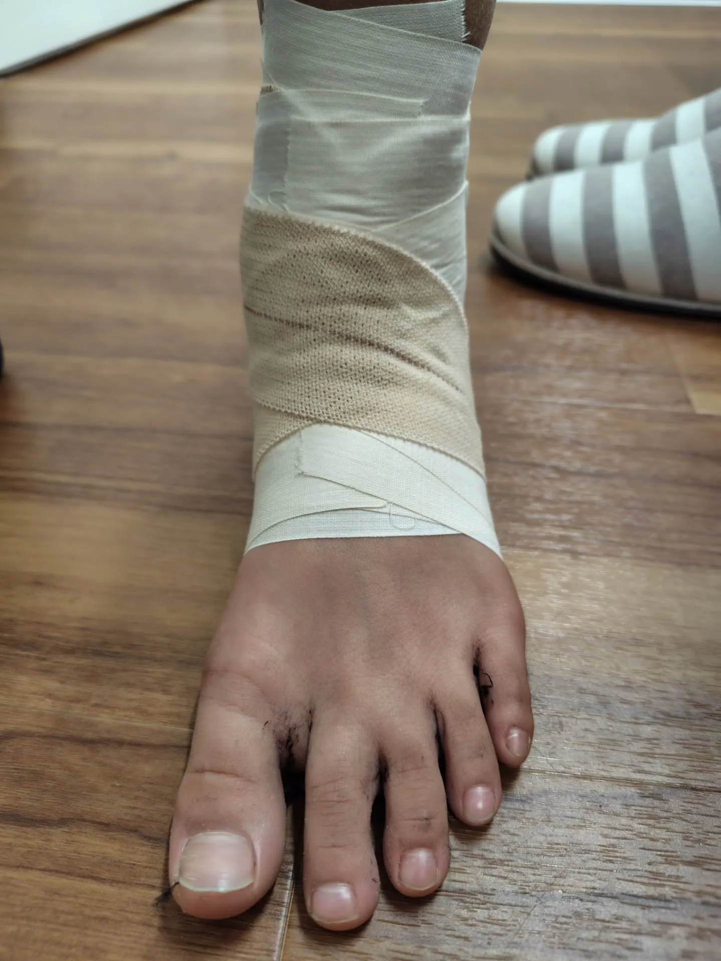 学校で階段降りていた時に足首を捻り、痛みが落ち着いたのでその...