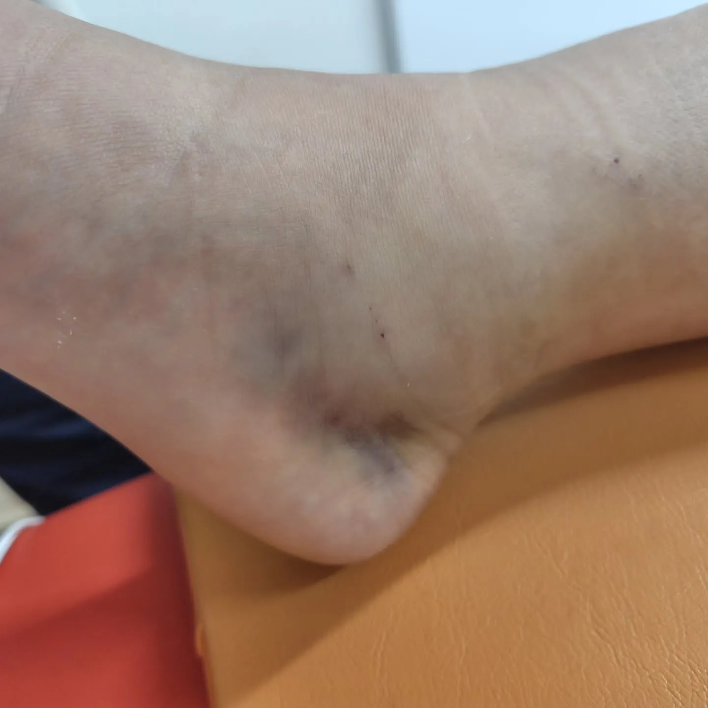 普段来られている患者さんのお孫さんでしたが、帰省中に「段差か...