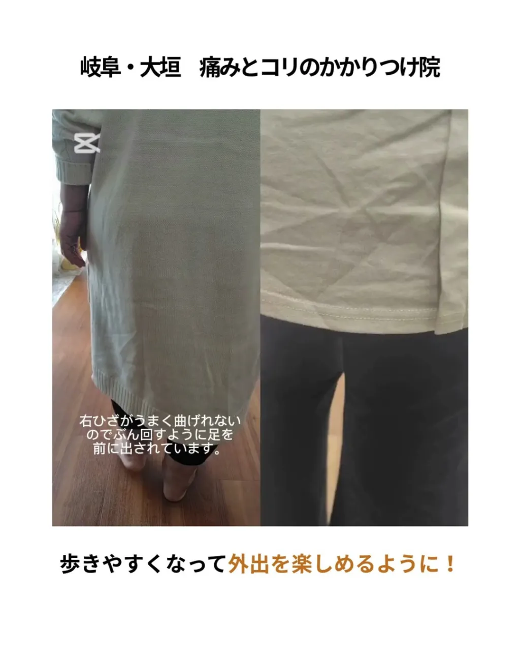 初回の歩行の状態と3か月ほど施術と